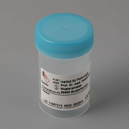 20ml Urinzytologie